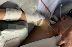 贵州8岁女童被砍瘫痪 继父行凶后自杀未遂被刑拘-小瑾